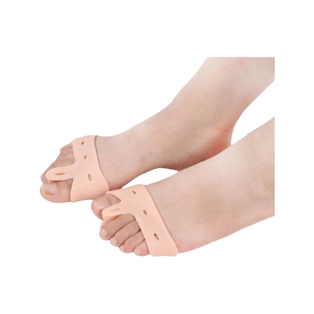 Hallux valgus (2st)